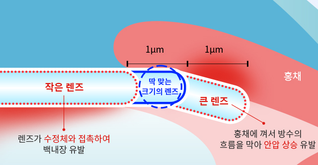 딱 맞는 크기의 렌즈 삽입