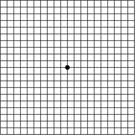 암슬러 테스트 결과 정상인의 시야